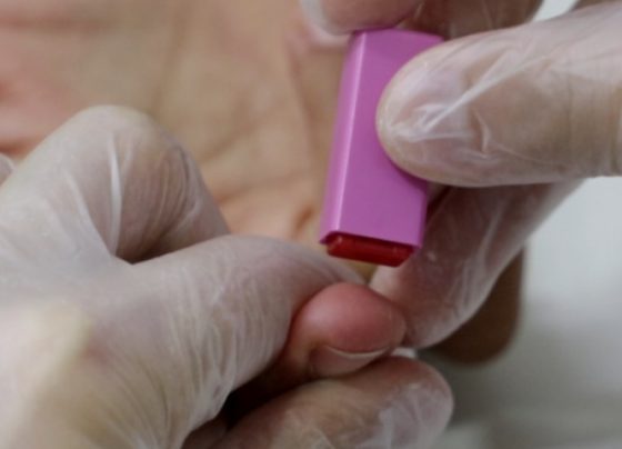 Campanha Julho Amarelo ressalta as hepatites virais