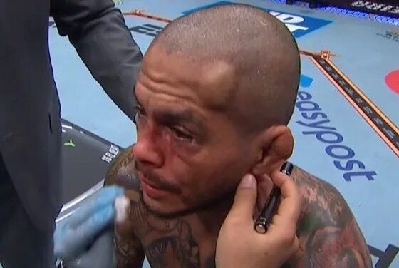 Lutador deixa brasileiro com galo na testa em nocaute no UFC