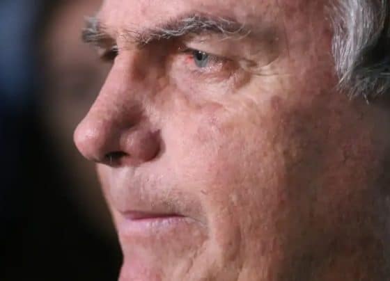 Com crise persistente de soluços, Bolsonaro faz nova cirurgia – RO Acontece