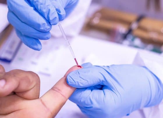 Ipesaúde destaca importância da prevenção e do conhecimento sobre vírus HTLV-1