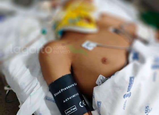 Jovem entregador segue em estado grave após acidente de moto em Lagarto