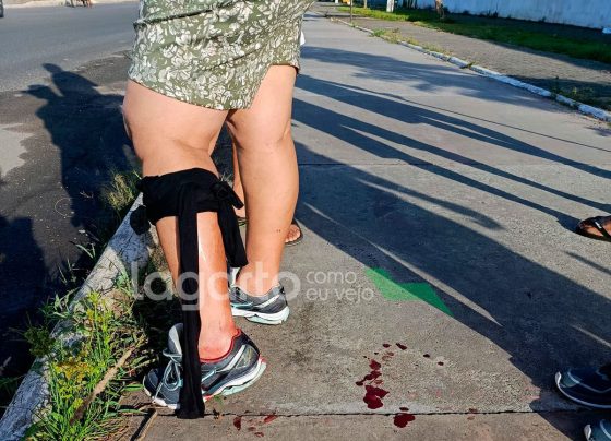 Mulher é mordida por cachorro durante caminhada na Cidade Nova, em Lagarto