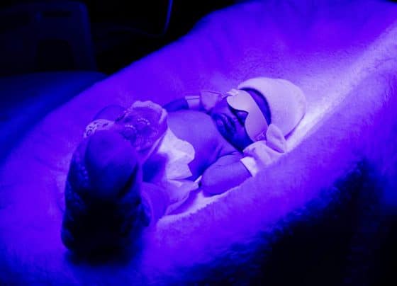 Fototerapia garante cuidado seguro aos recém-nascidos na Maternidade Nossa Senhora de Lourdes