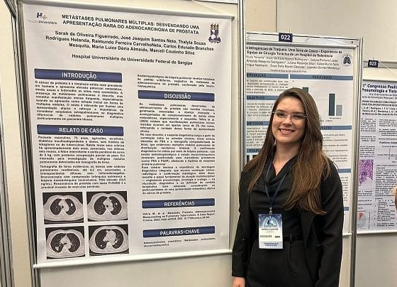 Residente do HU-UFS é a única brasileira selecionada para curso intensivo internacional de Pneumologia