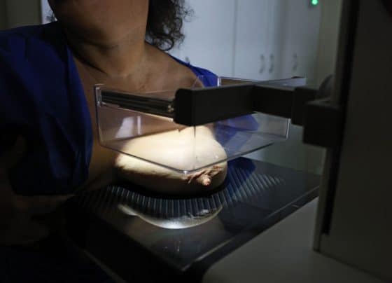 Vigitel: 92% das brasileiras entre 50 e 69 anos fizeram mamografia