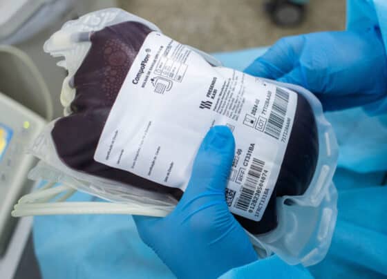 Hemose promove terceira edição do ‘Sabadão Solidário’ neste sábado, 21