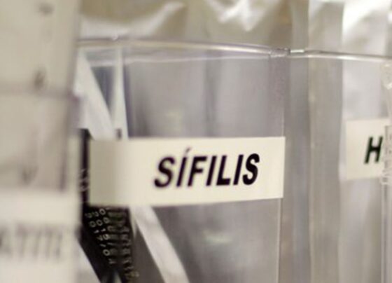 Centro de SP tem testagem grátis de HIV, hepatite, síflis e gonorreia