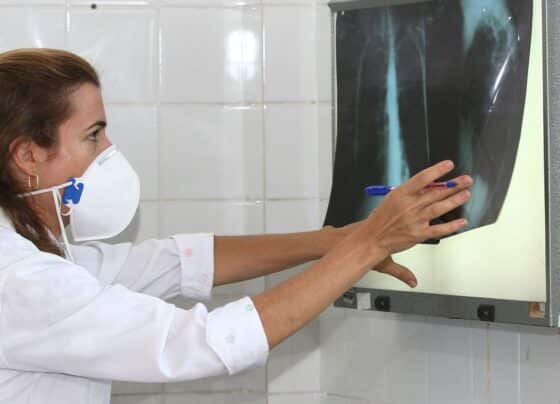OMS recomenda testes de diagnóstico rápido para erradicar tuberculose