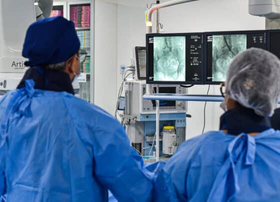 Centro de Hemodinâmica do Huse realiza procedimento endovascular inédito e amplia tratamento de trombose na rede pública de Sergipe