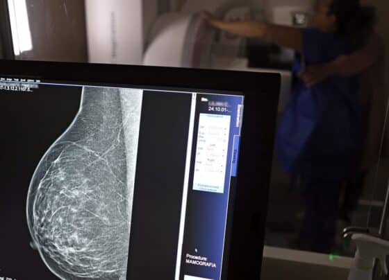 Nova lei reforça direito a três folgas por ano para exames preventivos