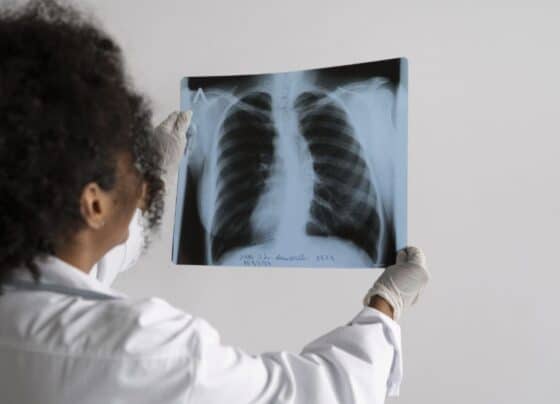 Ipesaúde alerta para importância dos cuidados preventivos contra doenças respiratórias