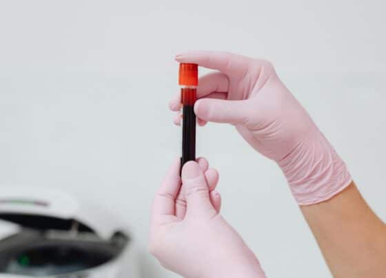 Sustentabilidade na gestão hospitalar: Iamspe integra rede de doadores da Hemobrás