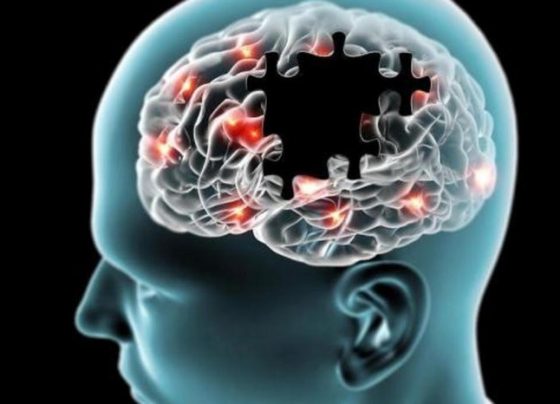 Alzheimer: novo medicamento pode reduzir declínio cognitivo em 50%