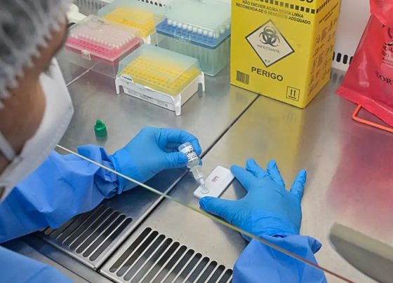 Anvisa atualiza regras sobre controle de qualidade em laboratórios