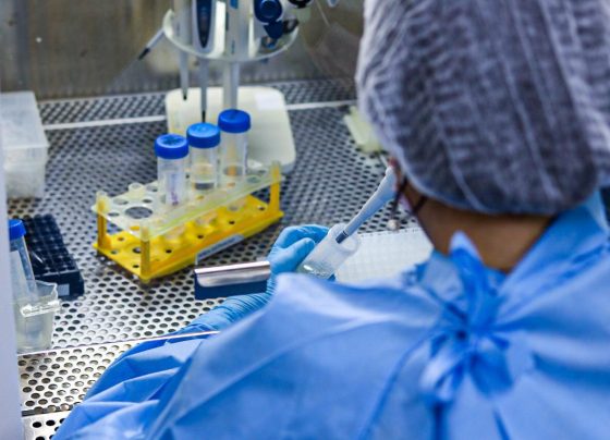 Lacen amplia recebimento de amostras para exame de HPV-DNA