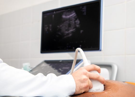 Novos aparelhos de ultrassonografia reforçam assistência e ampliam capacidade de atendimento no Caism