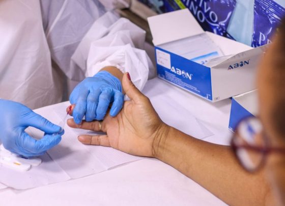 Unidade móvel ‘Fique Sabendo’ disponibilizará testes rápidos de ISTs e preservativos na 25ª Parada LGBTQIAPN+