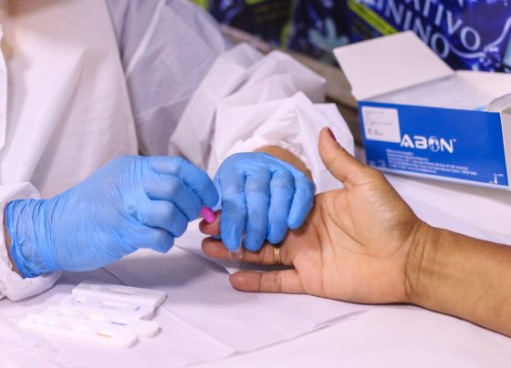 Unidade móvel ‘Fique Sabendo’ disponibilizará testes rápidos de ISTs  na 25ª Parada LGBTQIAPN+