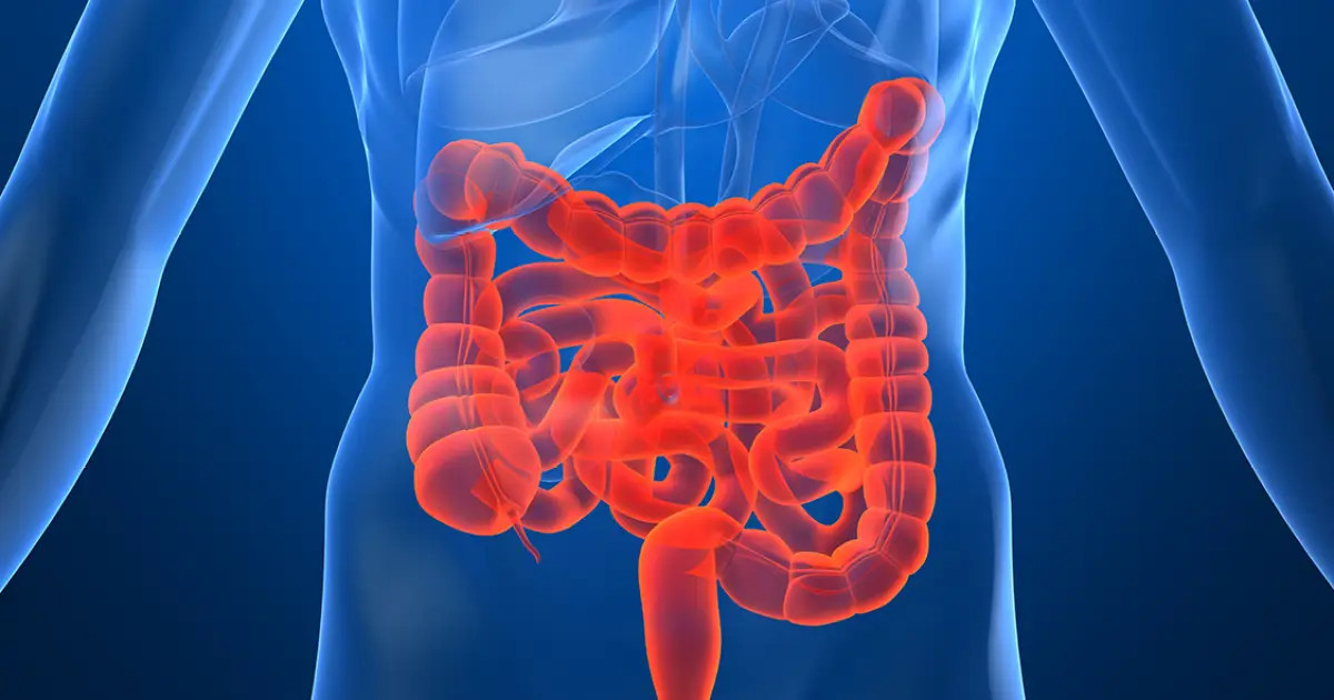 Em 13 anos, doença inflamatória intestinal cresce cinco vezes no Brasil