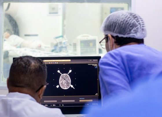Huse realiza biópsia cerebral de alta precisão em criança de 3 anos