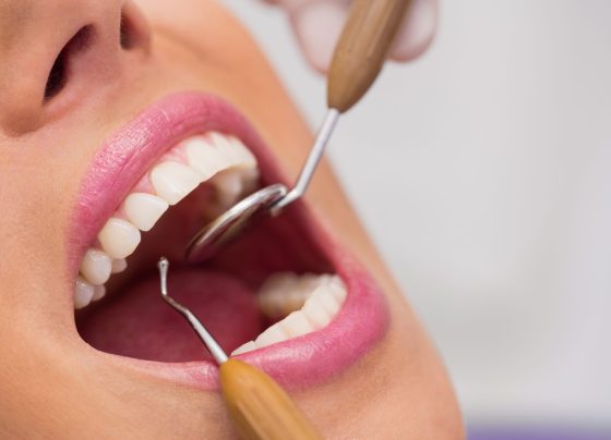 Semana Estadual reforça prevenção e diagnóstico precoce do câncer de boca em Sergipe