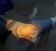 ITPS ORIENTA SOBRE CUIDADO NO PREPARO E ARMAZENAMENTO DE MARMITAS; MICROBIOLOGISTA ALERTA PARA OS RISCOS